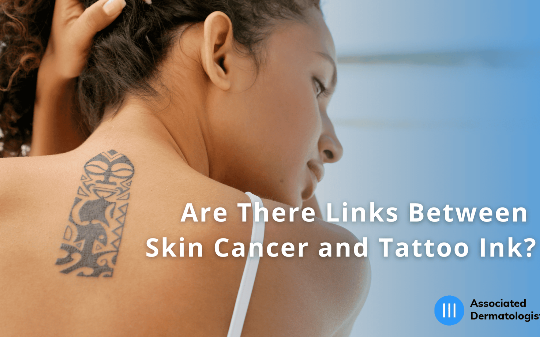 A close-up shot from the back shows a person with a tattoo on their left shoulder blade. The tattoo is a rectangular, tribal-style design in black ink. The person has dark, curly hair pulled up, and is wearing a white strap over their shoulder. The background is a gradient of blue and white, with text overlayed that reads: "Are There Links Between Skin Cancer and Tattoo Ink?" Below the text, a logo for "Associated Dermatologists" is visible in the bottom right corner.