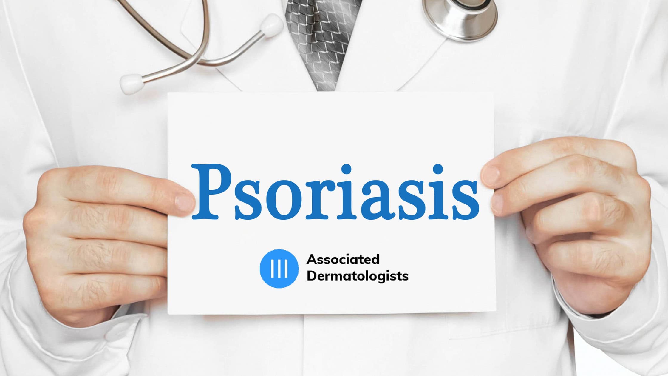 Psoriasis.2 Warts Treatments