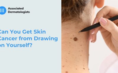 Can You Get Skin Cancer from Drawing on Yourself?