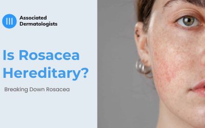 Is Rosacea Hereditary?