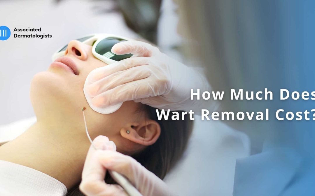 Wart Removal Cost