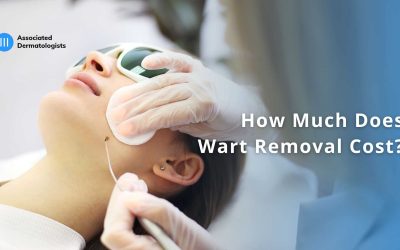 How Much Does Wart Removal Cost?