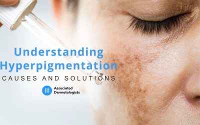 Understanding Hyperpigmentation: Causes and Solutions