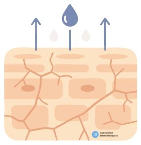 Dry Skin
