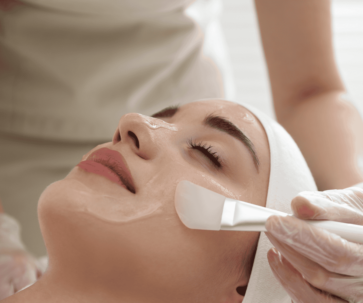 Chemical Peel Process for Acne Removal